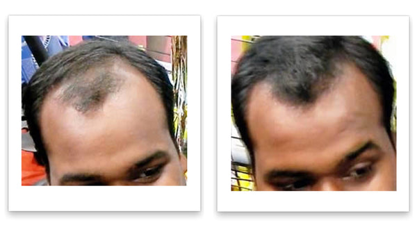 Caboki 10X Hair Powder - Enhances Hairline, Hair Volume, Root Touch Up. Talc-Free, Mica-Free.