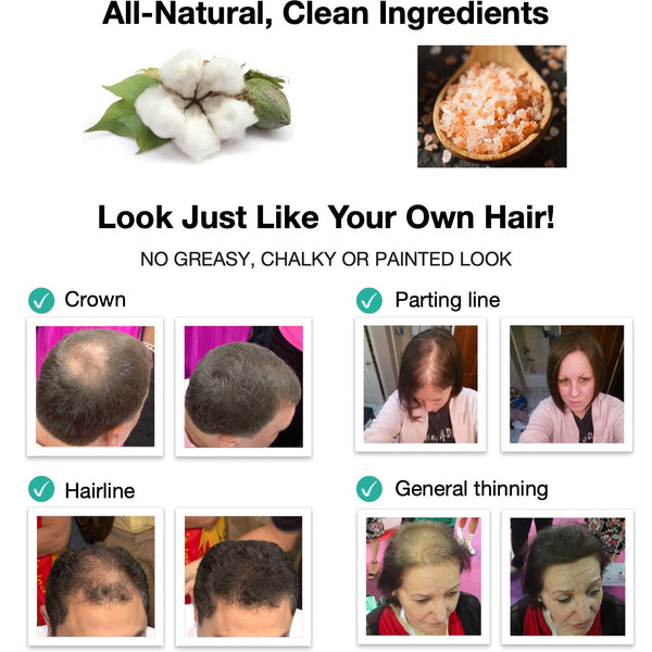 Caboki Hair Fiber, All-Natural Hair Loss Concealer (30 Gram, 90-day supply)