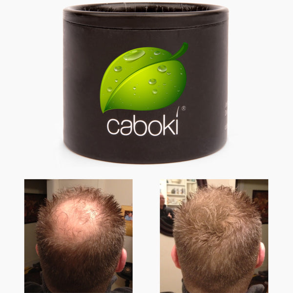 Caboki Free Sample