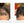 Before and after image of a man with short curly black hair with a bald spot on the crown and front scalp