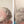 Before and after image of a person with short wavy gray hair and a bald spot on their crown
