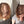 Before and after image of a woman with short wavy light brown hair and thin hair on her parting line