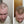 Before and after image of a man with short straight light brown hair whose hair is thinning on his frontal scalp