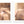 Before and after image of a woman with golden blonde hair with thin hair on her crown